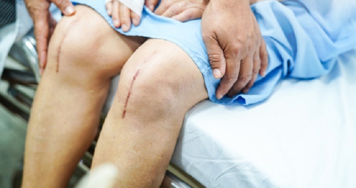 مشکلات بعد از عمل زانو: خشکی و صدا دادن زانو، آسیب عصب و لختگی خون