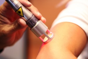 Laser-on-elbow-photo-for-Individual-Page-on-Laser-Therapy