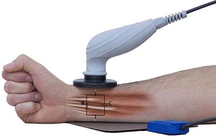 تکار تراپی (Tecar Therapy) چیست و چه کاربردهای درمانی دارد؟