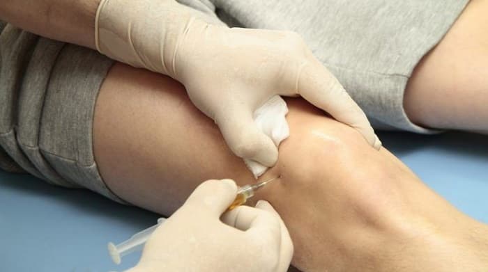 مراقبت بعد از تزریق زانو